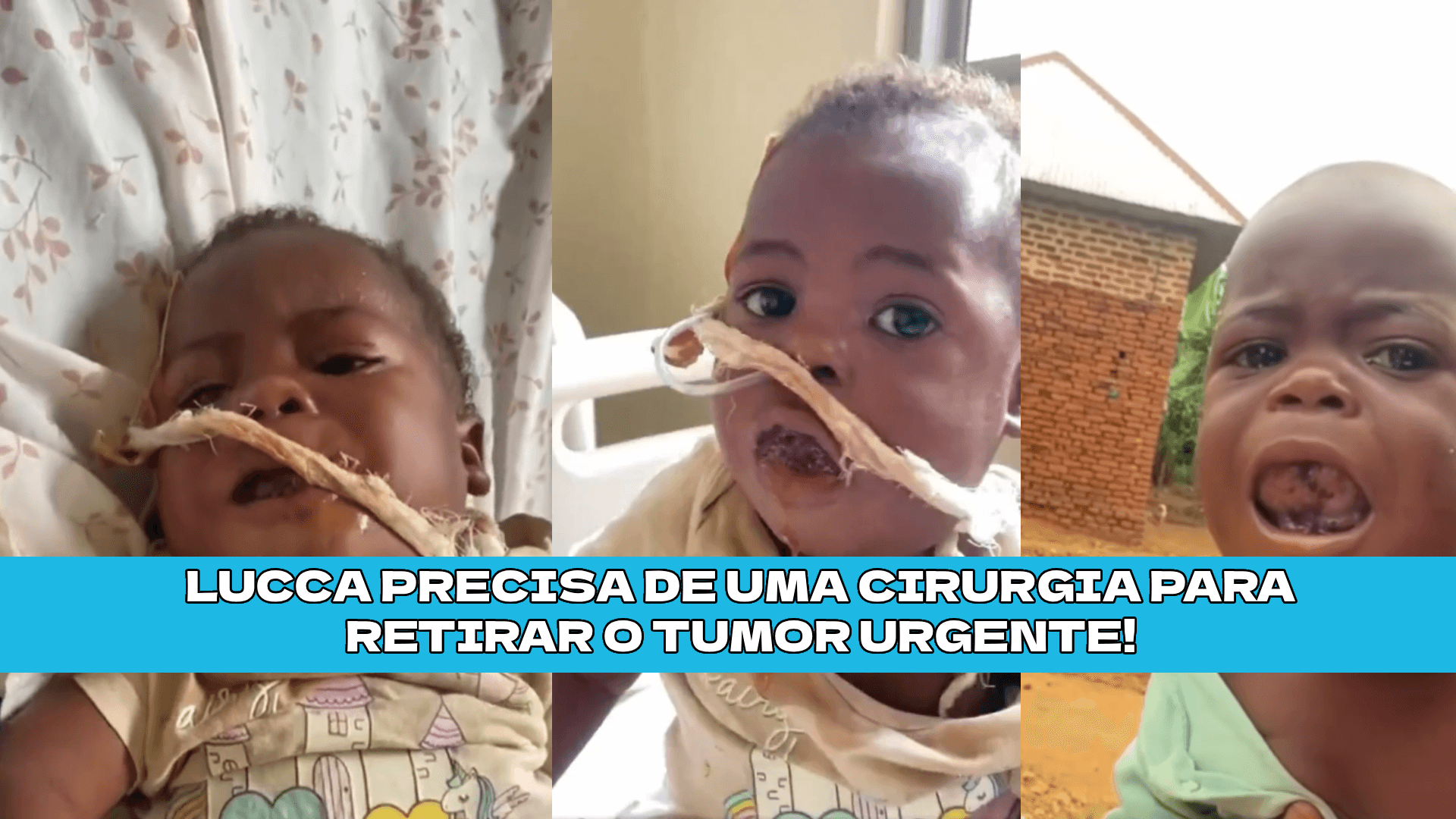 Ajude o Lucca a remover tumor da boca, ele conta com sua ajuda!